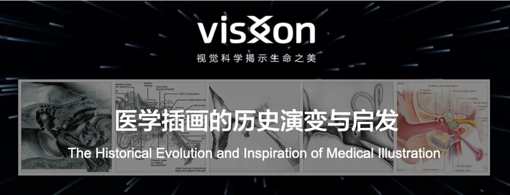 Visxon：医学插画的历史演变与启发
